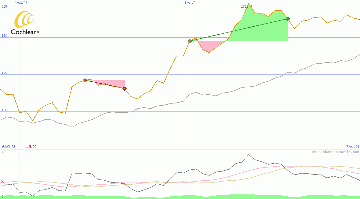 Cochlear Ltd